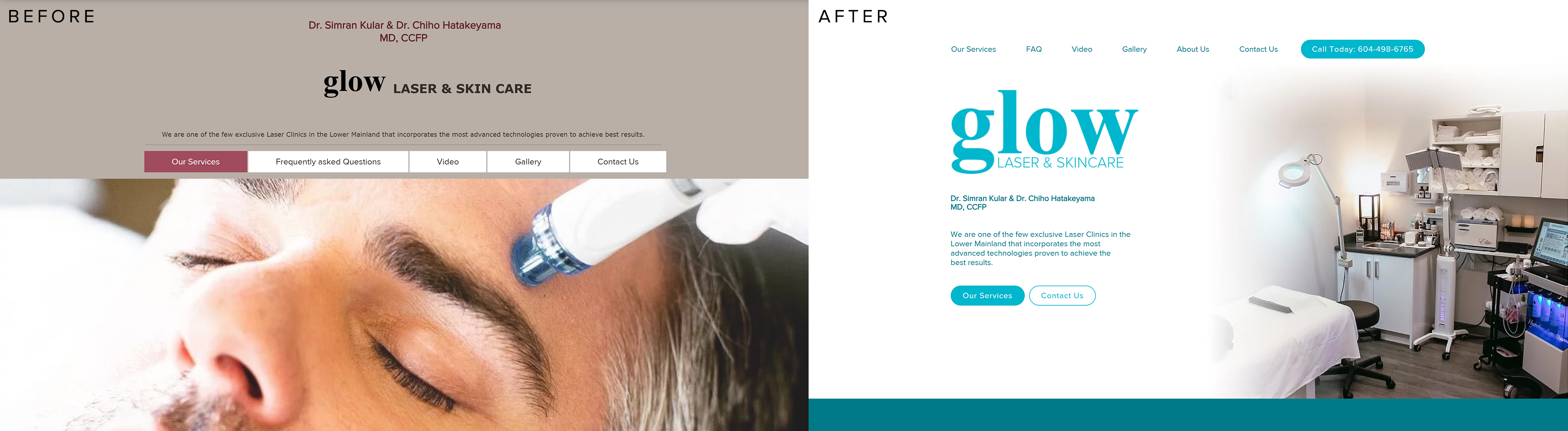 Figure 2: Lin, G. (Fall 2020). Before and after of Glow Laser & Skincare’s Landing page [Edited Screenshot]